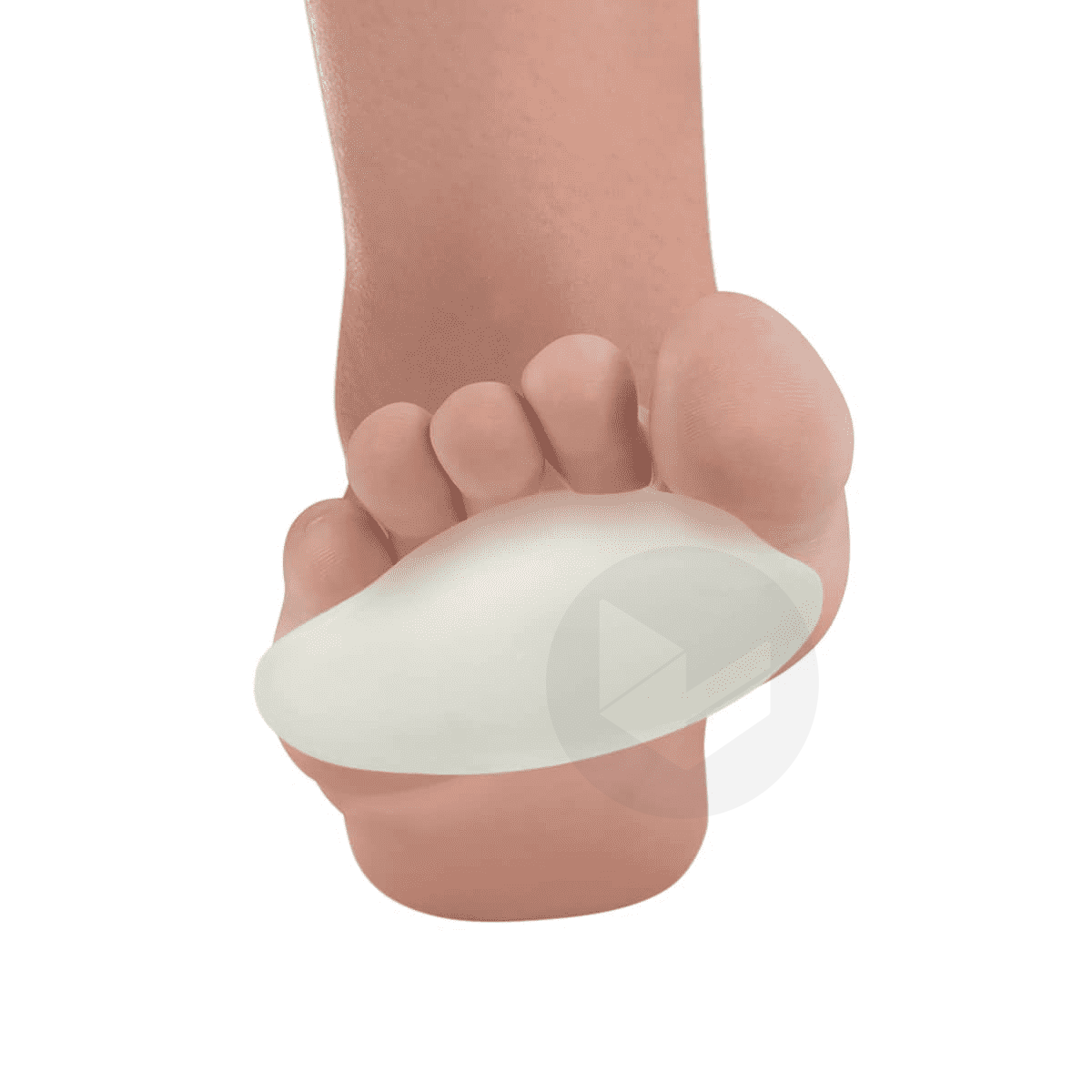 Protection plantaire gel métatarses